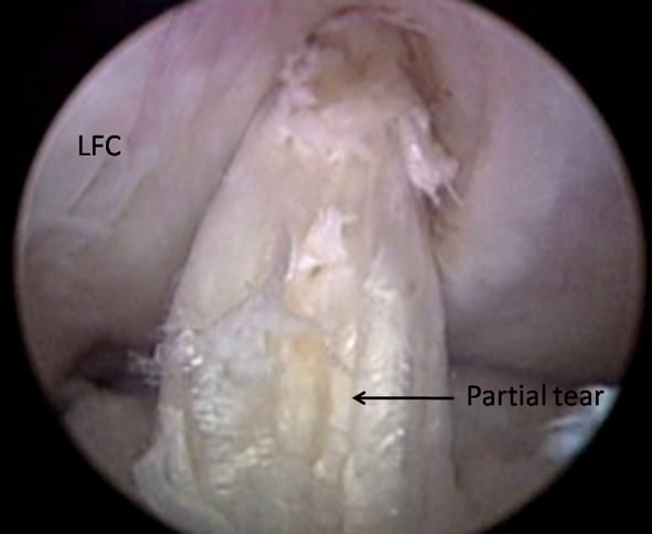 Fig. 5