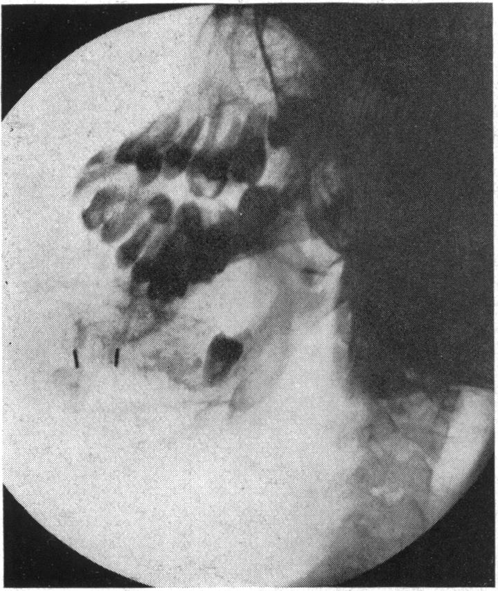 FIG. 13.