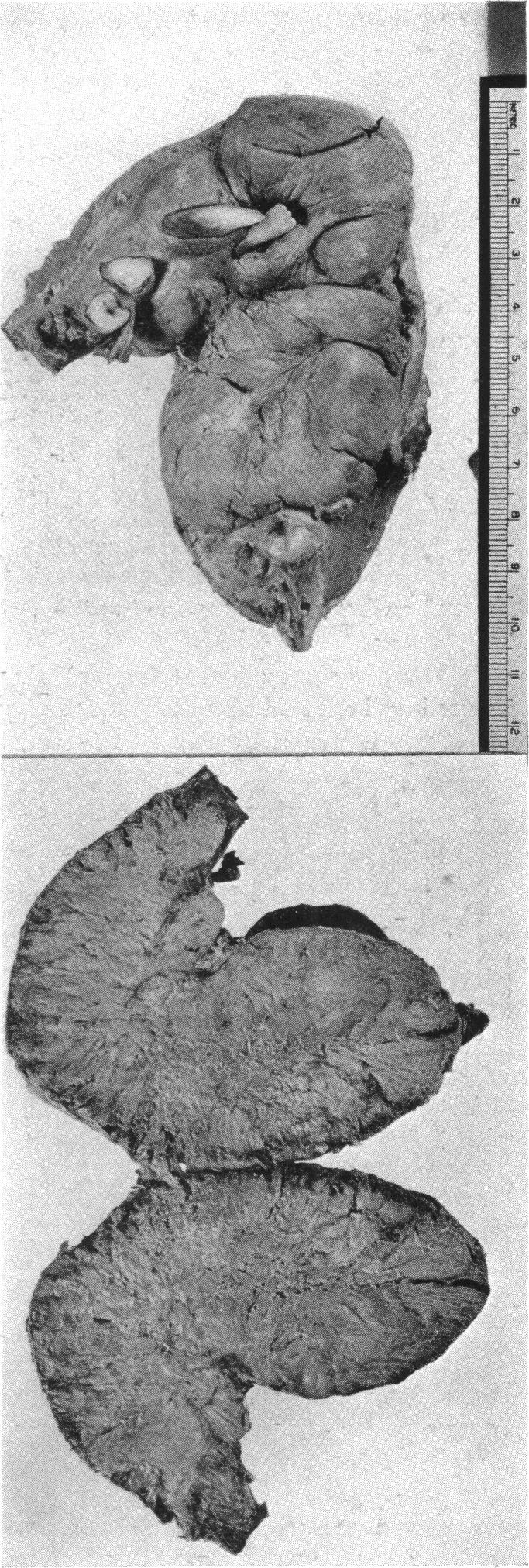 FIG. 14, 16.