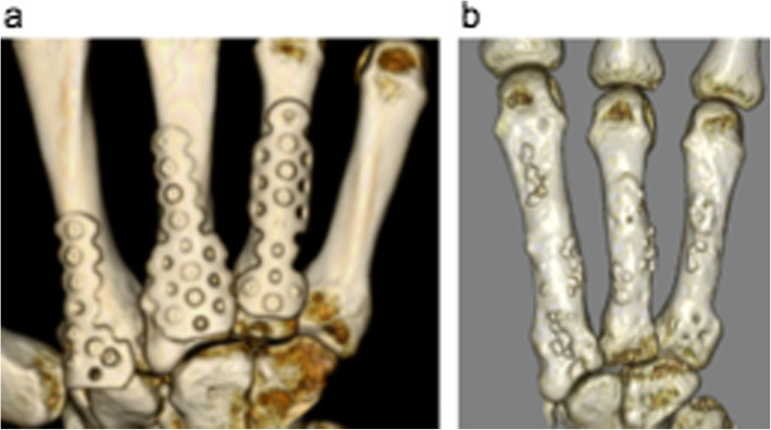 Fig. 14