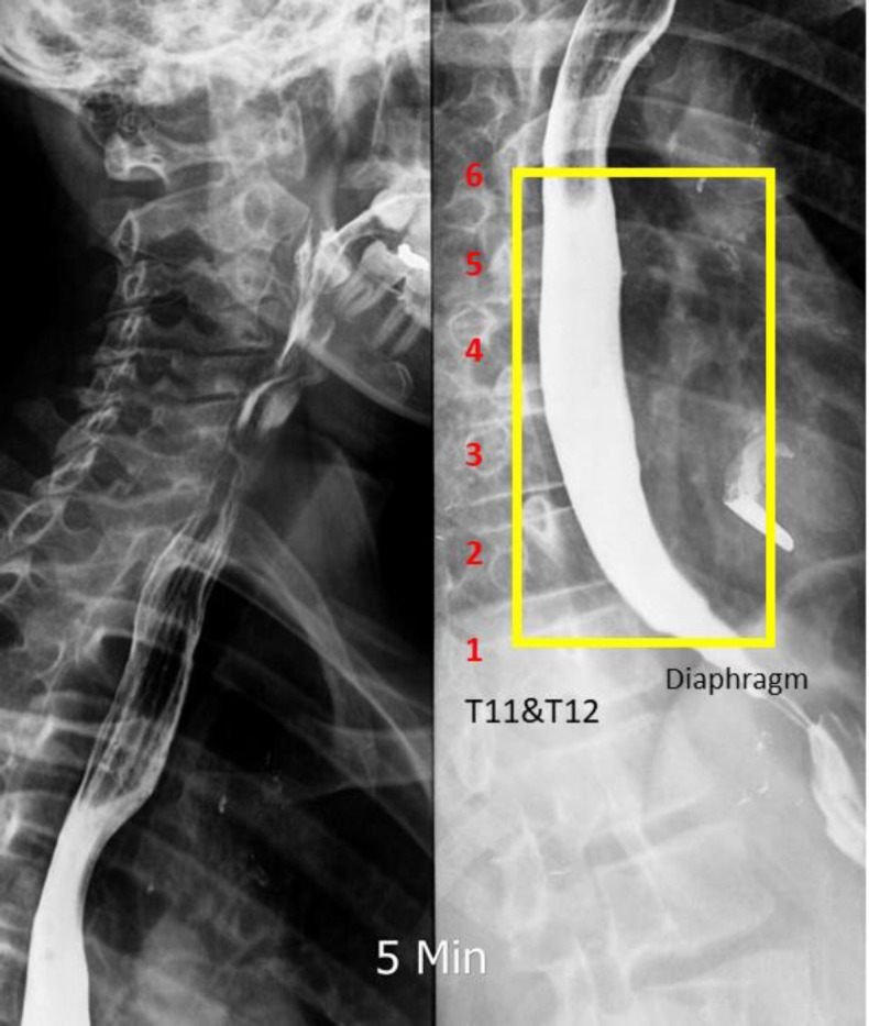 Figure    2 