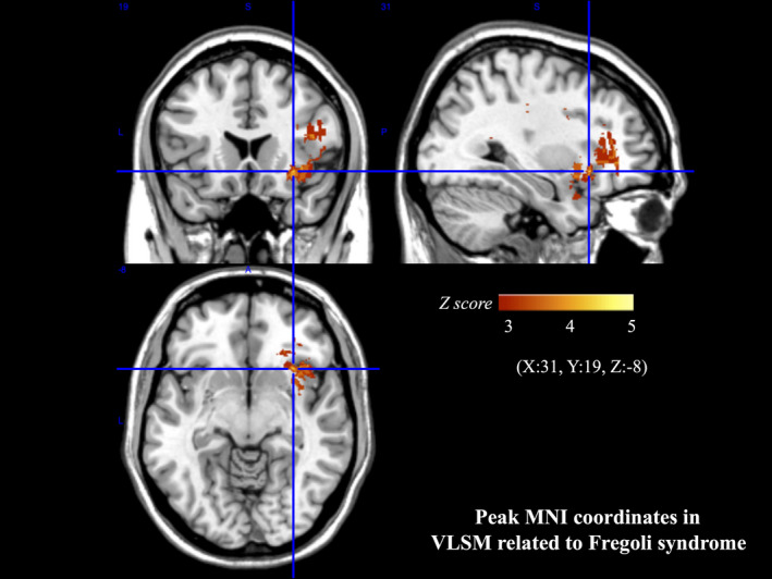 FIGURE 3