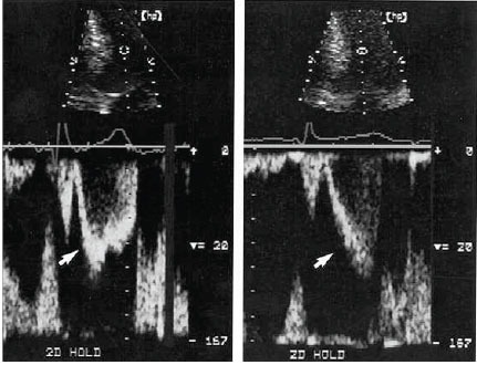 Fig. (4)