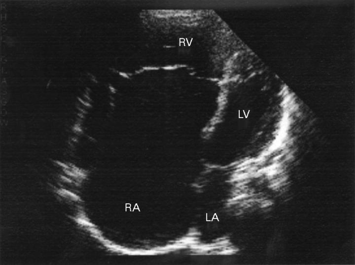 Figure 25  