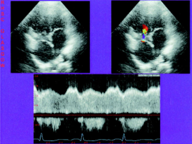 Figure 28  