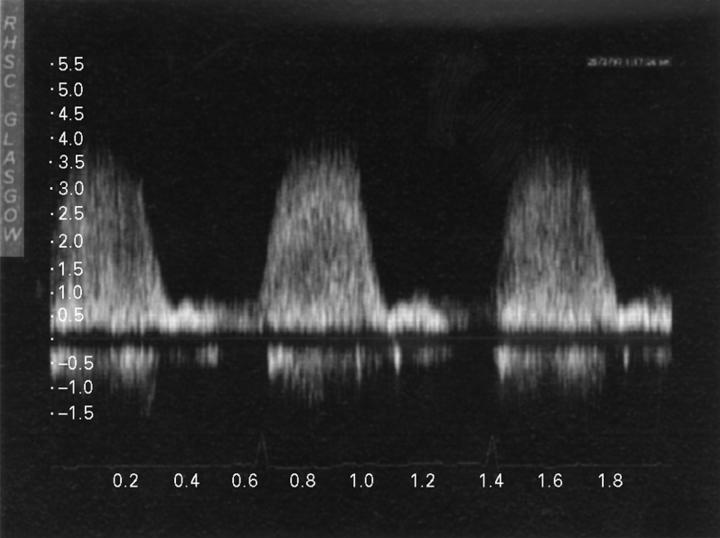 Figure 16  