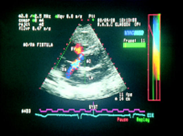 Figure 14  