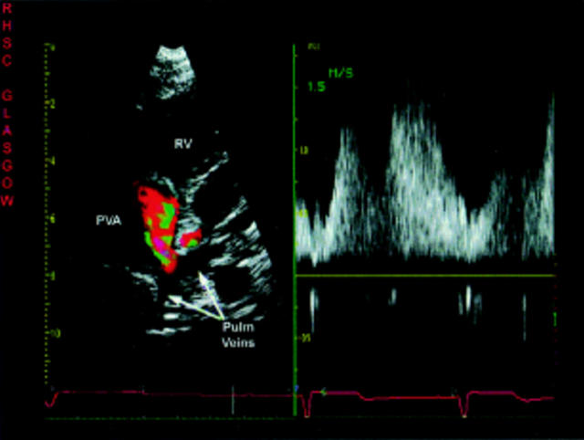 Figure 32  