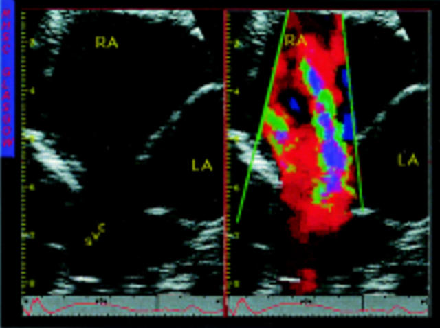 Figure 3  