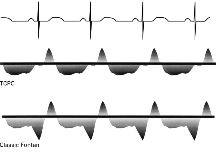 Figure 30  