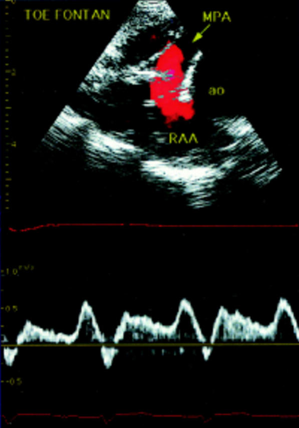 Figure 29  