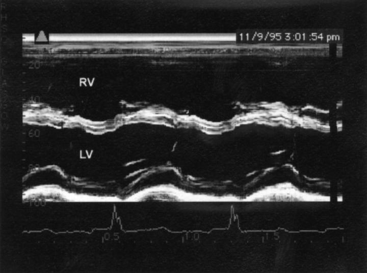 Figure 1  