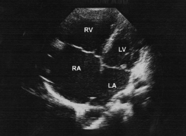 Figure 2  