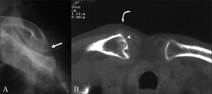 Figure 3 (A, B)