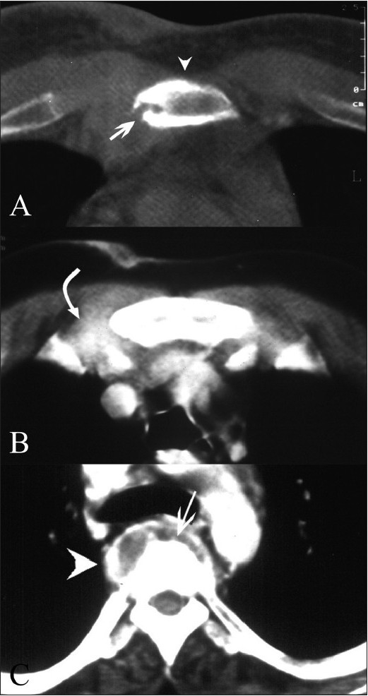 Figure 2 (A–C)