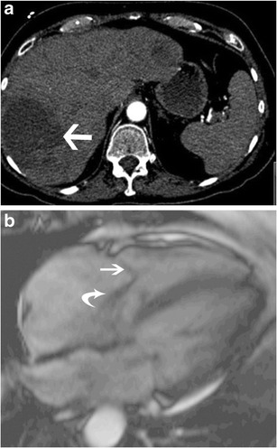 Fig. 20