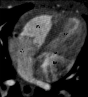 Fig. 17