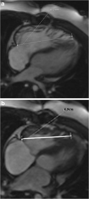 Fig. 12