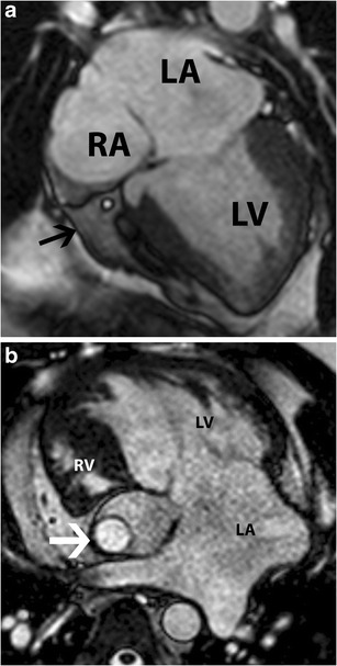 Fig. 13