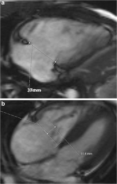 Fig. 11