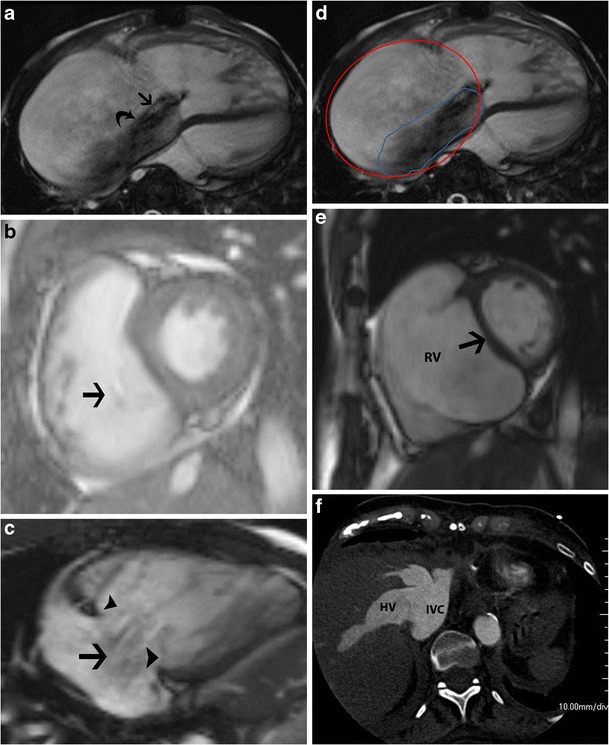 Fig. 10