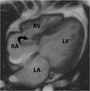 Fig. 16