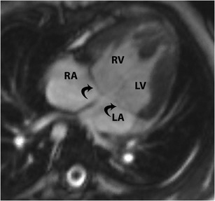 Fig. 18