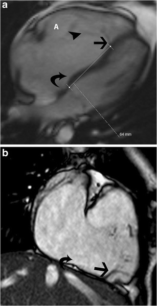 Fig. 14