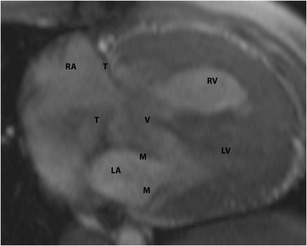 Fig. 19