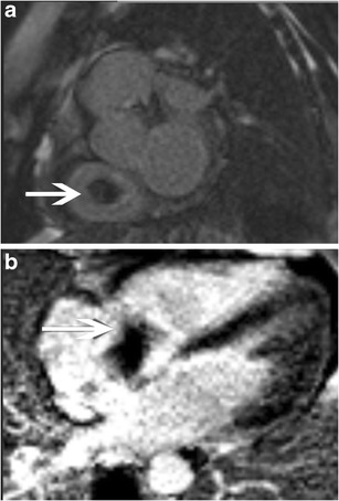 Fig. 22