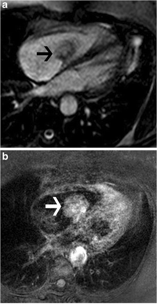 Fig. 24