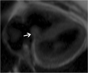 Fig. 25