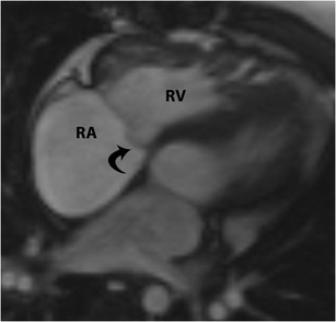 Fig. 28