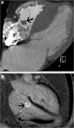 Fig. 23