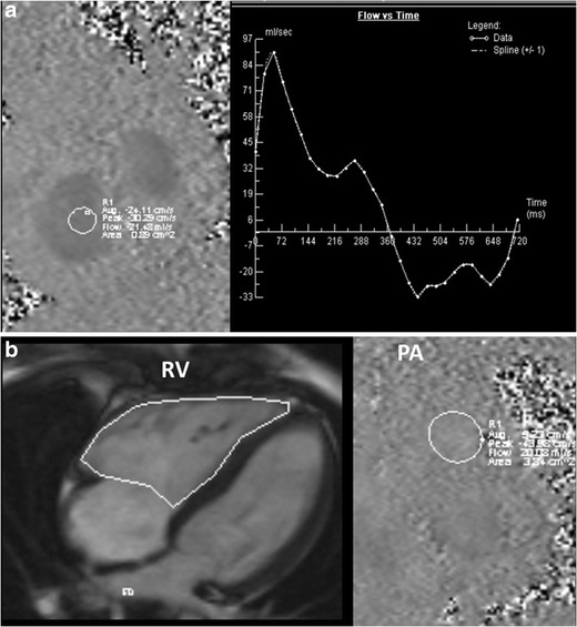 Fig. 9