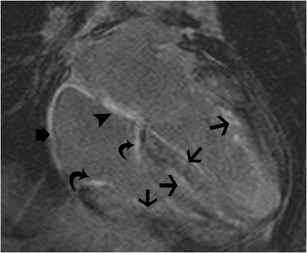 Fig. 29