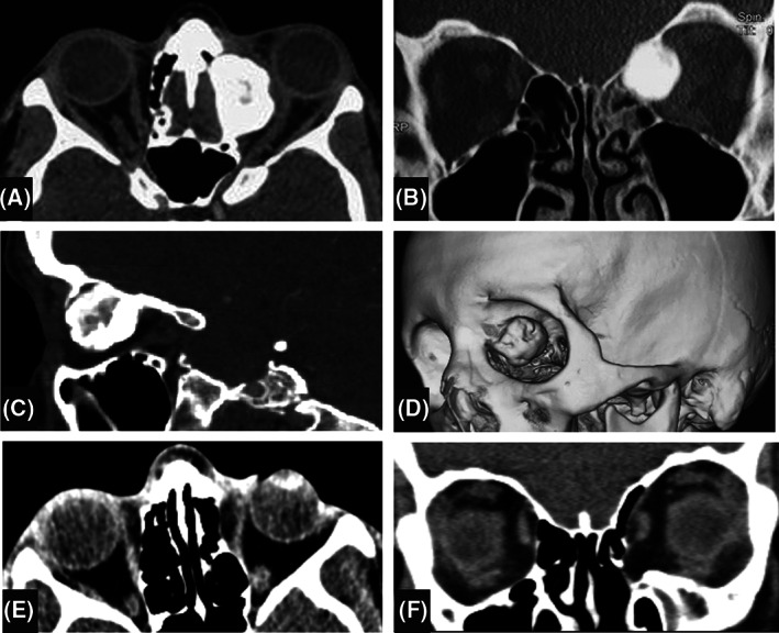 FIGURE 2