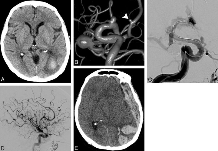 Fig 2.