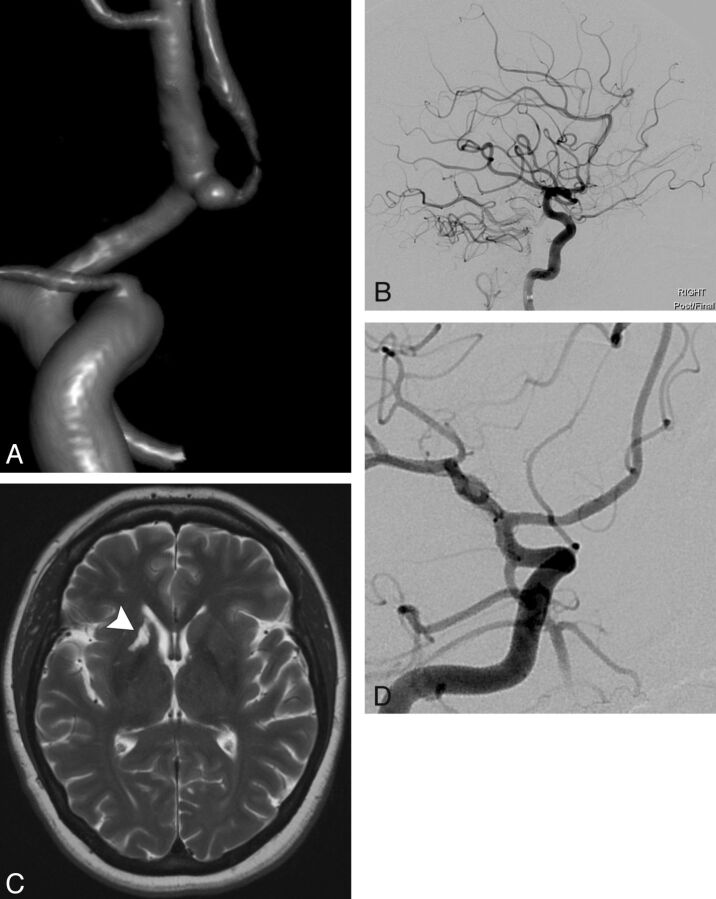 Fig 1.