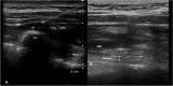 Fig. 10