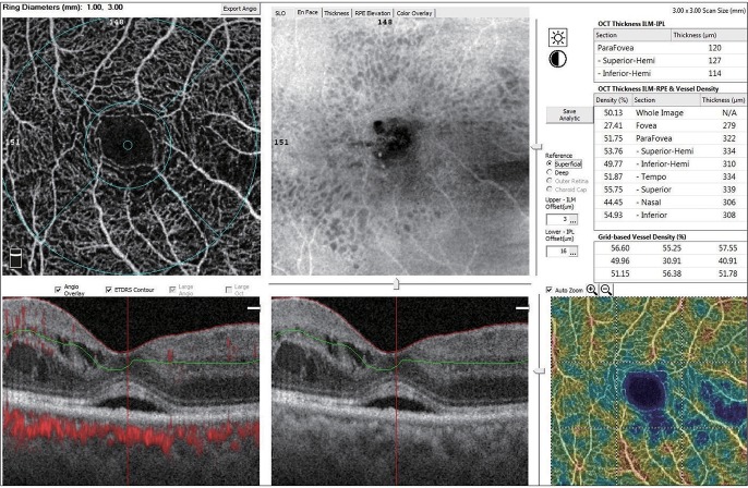 Fig. 2