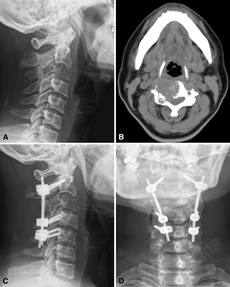 Fig. 3A–D