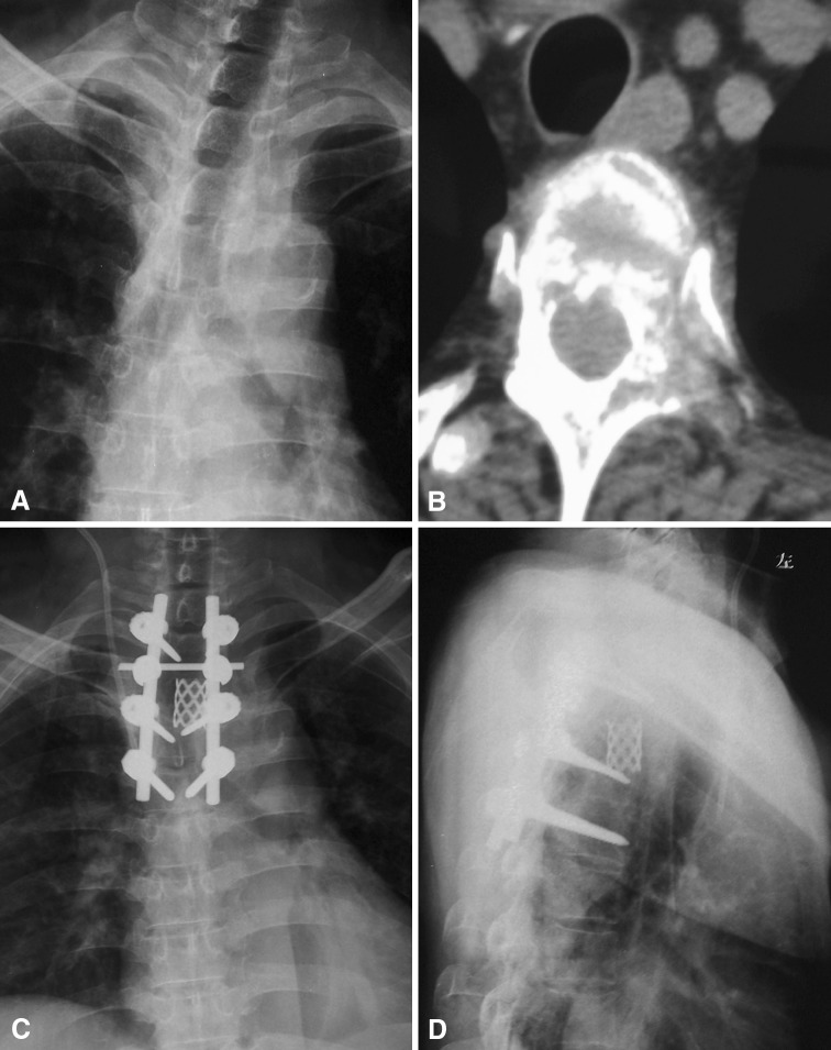 Fig. 4A–D