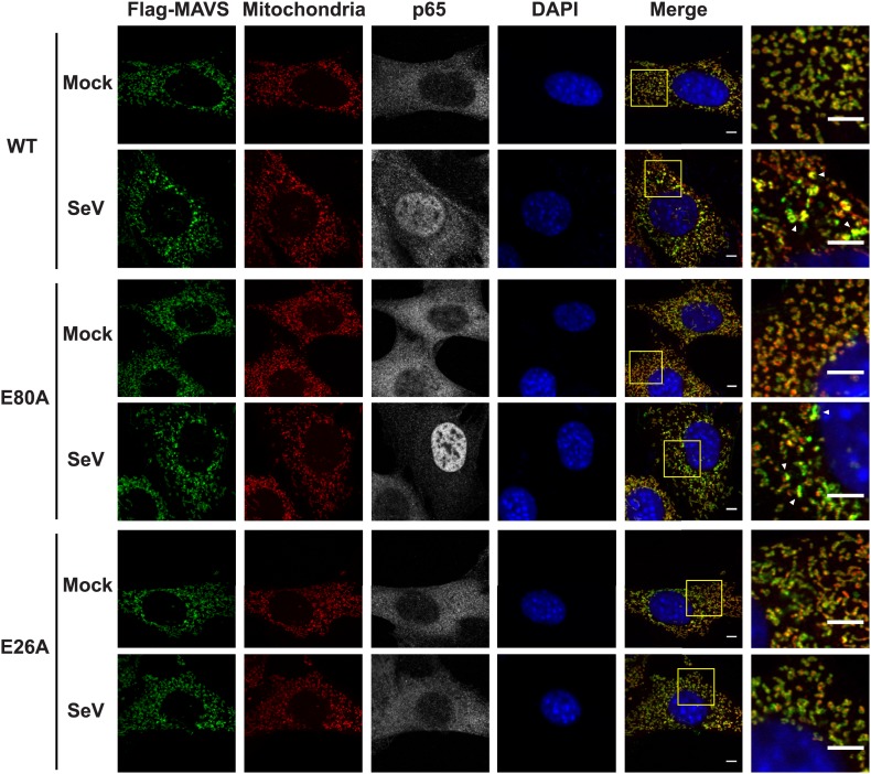 Figure 5—figure supplement 1.