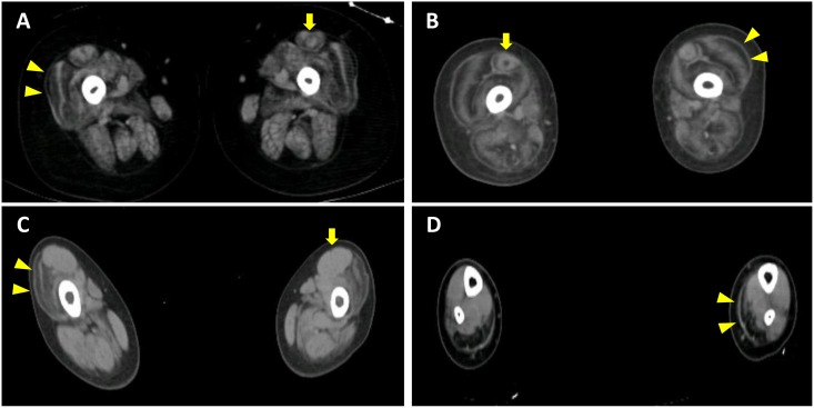 Fig 2