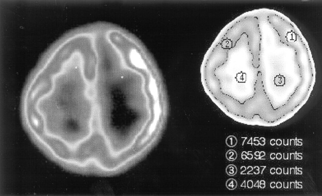 Fig 2.