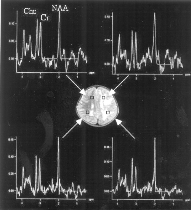 Fig 3.