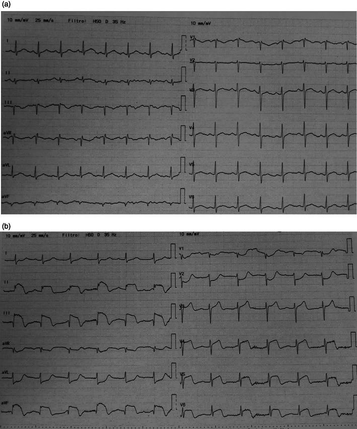 FIGURE 2