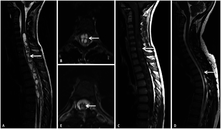 Fig. 13