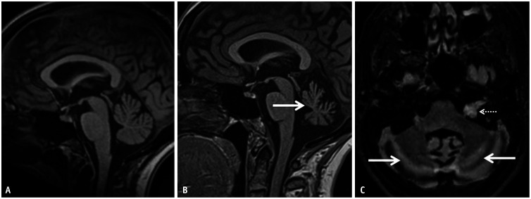 Fig. 18